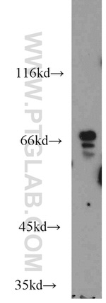 TAF6L Antibody in Western Blot (WB)