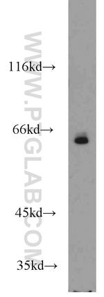 TAF6L Antibody in Western Blot (WB)