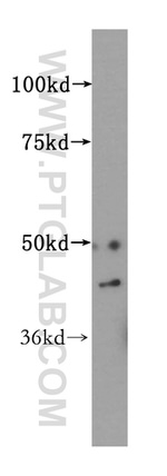 ALDH3B2 Antibody in Western Blot (WB)