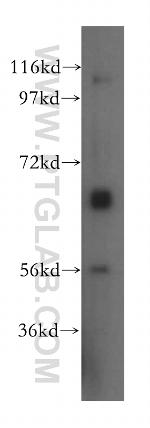 SLC7A4 Antibody in Western Blot (WB)