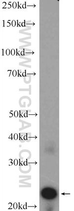 CRYBA2 Antibody in Western Blot (WB)