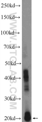 CRYBA2 Antibody in Western Blot (WB)