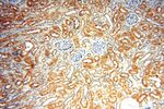 TRBP Antibody in Immunohistochemistry (Paraffin) (IHC (P))