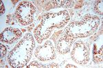 TRBP Antibody in Immunohistochemistry (Paraffin) (IHC (P))