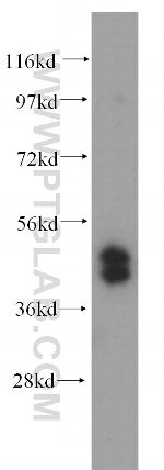 TRBP Antibody in Western Blot (WB)