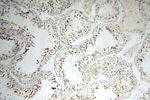 MEK5 Antibody in Immunohistochemistry (Paraffin) (IHC (P))