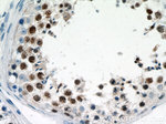 MEK5 Antibody in Immunohistochemistry (Paraffin) (IHC (P))