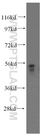 MEK5 Antibody in Western Blot (WB)