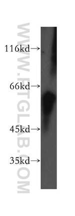 MEK5 Antibody in Western Blot (WB)