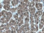 LHPP Antibody in Immunohistochemistry (Paraffin) (IHC (P))