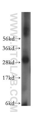 LHPP Antibody in Western Blot (WB)