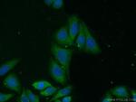 CHMP1A Antibody in Immunocytochemistry (ICC/IF)