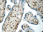 CHMP1A Antibody in Immunohistochemistry (Paraffin) (IHC (P))