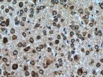 CHMP1A Antibody in Immunohistochemistry (Paraffin) (IHC (P))