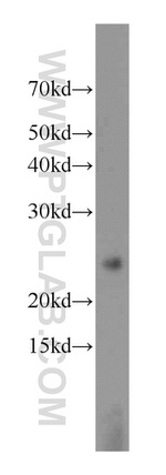 CHMP1A Antibody in Western Blot (WB)