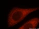 NQO2 Antibody in Immunocytochemistry (ICC/IF)