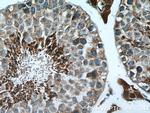 NQO2 Antibody in Immunohistochemistry (Paraffin) (IHC (P))