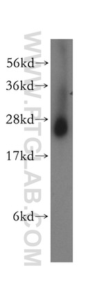 NQO2 Antibody in Western Blot (WB)