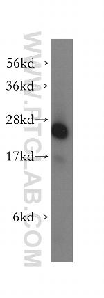 NQO2 Antibody in Western Blot (WB)