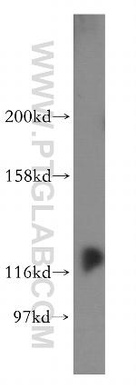 DDX24 Antibody in Western Blot (WB)