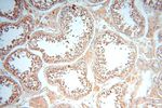 VAC14 Antibody in Immunohistochemistry (Paraffin) (IHC (P))