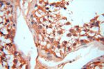 VAC14 Antibody in Immunohistochemistry (Paraffin) (IHC (P))