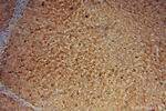 MGAT2 Antibody in Immunohistochemistry (Paraffin) (IHC (P))