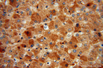 MGAT2 Antibody in Immunohistochemistry (Paraffin) (IHC (P))