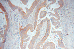 RAB3B Antibody in Immunohistochemistry (Paraffin) (IHC (P))