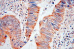 RAB3B Antibody in Immunohistochemistry (Paraffin) (IHC (P))