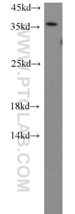 HTRA2 Antibody in Western Blot (WB)