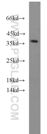 HTRA2 Antibody in Western Blot (WB)