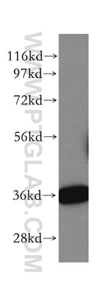 HTRA2 Antibody in Western Blot (WB)