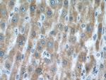 VARS2 Antibody in Immunohistochemistry (Paraffin) (IHC (P))