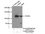 VARS2 Antibody in Immunoprecipitation (IP)