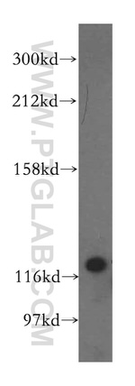 VARS2 Antibody in Western Blot (WB)