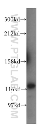 VARS2 Antibody in Western Blot (WB)