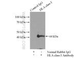 HLA class I (HLA-C) Antibody in Immunoprecipitation (IP)