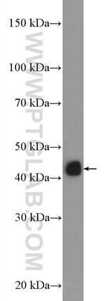 HLA class I (HLA-C) Antibody in Western Blot (WB)