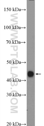 HLA class I (HLA-C) Antibody in Western Blot (WB)