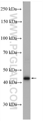 RBM41 Antibody in Western Blot (WB)