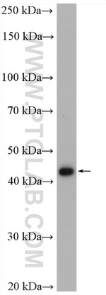 RBM41 Antibody in Western Blot (WB)