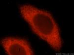 VTA1 Antibody in Immunocytochemistry (ICC/IF)