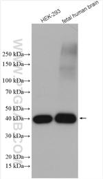 VTA1 Antibody in Western Blot (WB)