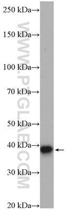 VTA1 Antibody in Western Blot (WB)