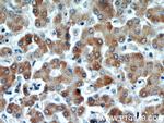 PIN4 Antibody in Immunohistochemistry (Paraffin) (IHC (P))