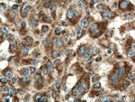 PIN4 Antibody in Immunohistochemistry (Paraffin) (IHC (P))