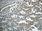 TNFAIP8 Antibody in Immunohistochemistry (Paraffin) (IHC (P))