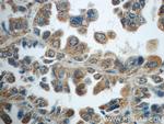 TNFAIP8 Antibody in Immunohistochemistry (Paraffin) (IHC (P))