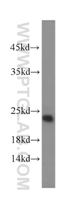 TNFAIP8 Antibody in Western Blot (WB)